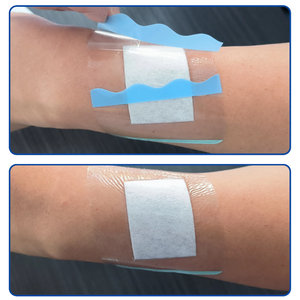 Hysent Best Quality Roll Premium <strong>Hydrocolloid</strong> Medical PU <strong>Film</strong> Wound Dressing - Product Image 5