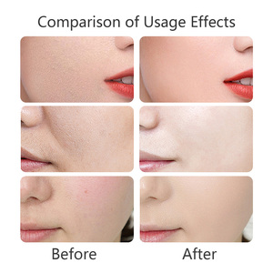 <span class=keywords><strong>Crème</strong></span> Hydratante au Suif de Bœuf Biologique Naturel en Gros sous Marque Blanche : Retient l'Humidité, <span class=keywords><strong>Crème</strong></span> de Soin au Beurre de Karité - Product Image 5