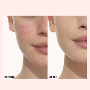 Phổ biến nhất 10 màu <span class=keywords><strong>Corrector</strong></span> độ nét cao kem che khuyết điểm trang điểm Concealer đường viền thanh - Product Image 6