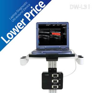 Sistema <span class=keywords><strong>de</strong></span> Ultrasonido Doppler Color Portátil Tipo Laptop Totalmente Digital DW-L3i con Imágenes 3D <span class=keywords><strong>de</strong></span> <span class=keywords><strong>Brazo</strong></span> Libre - Product Image 1