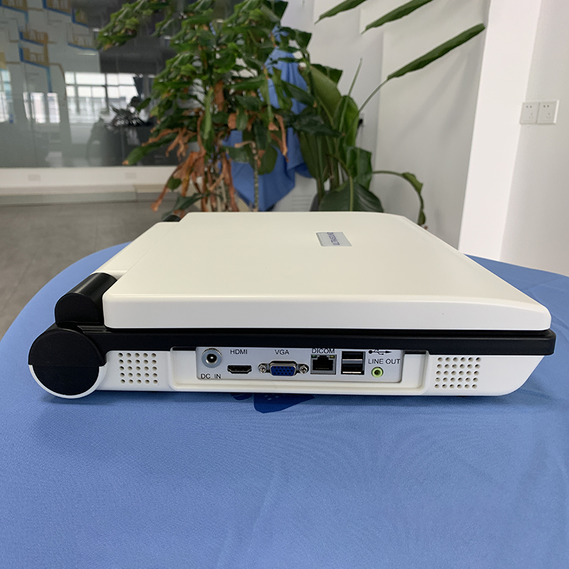 MN-E20 Hospital Medical 3D Laptop Ultrasound Machine Full Digital Ultrasound Scanner with Multi-language