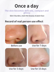 Nouveauté 2024 vente chaude petite bulle dissolvant de points noirs nettoyant Cycle de l'eau points noirs <span class=keywords><strong>aspirateur</strong></span> électrique dissolvant de points noirs - Product Image 2