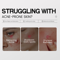 Sérum Visage Anti-Acné à 5% de Niacinamide Marque Blanche – Essence Liquide Éclaircissante Anti-Taches Brunes – Sérum Soin Fraise