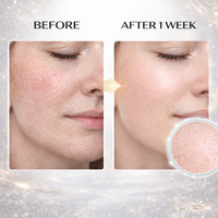Crème en Capsules PDRN Hydratante en Gros : Hydratation Profonde, Raffermissante, Lissante, Réduit la Sécheresse, Renforce la Barrière Cutanée