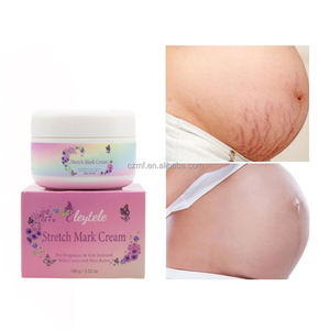 Crema Reparadora de Estrías de Marca Privada para el Cuidado de la Piel, Eliminación de Cicatrices del Embarazo, Crema Natural de Manteca de Karité para el Abdomen - Product Image 6