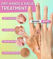 Masque pour les mains au lait naturel en gros, gants de soin hydratants et blanchissants, gants exfoliants