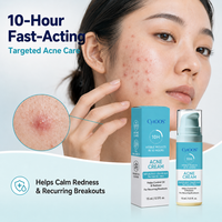Gel OEM de Ácido Salicílico para el Acné, Reparación Rápida y Efectiva, Anti-Manchas, Reduce Cicatrices de Acné, Reduce Poros, Crema Facial para el Acné