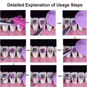 Ligature orthodontique en forme de fleurs de Mickey et de Kitty, produit d'hygiène bucco-<span class=keywords><strong>dentaire</strong></span> multifonctionnel - Product Image 6