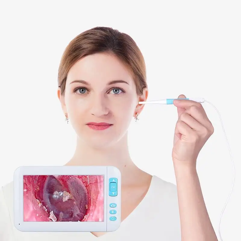 Kamera Endoskopi Hidung Portabel Digital, Endoskopi Telinga Video Diagnostik Telinga Layar 4.3 Inci 3.9Mm