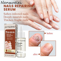 Sérum réparateur d'ongles Jaysuing de haute qualité et efficace, 7 jours, ingrédients à base de plantes, sérum réparateur d'ongles
