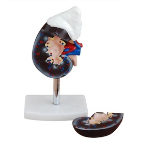 Modelo de riñón humano (2 partes) Modelo anatómico de riñón de entrenamiento escolar de hospital - Product Image 1