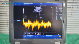 Échographe portable LED Jm-800f pour cardiologie et vascularisation, équipement Doppler PW, utilisation facile, faible consommation d'énergie Jm-800f - Product Image 3