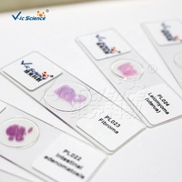 Human Pathology Prepared Slides Human Disease Microscope Slides Pathology Slides for Medical Students