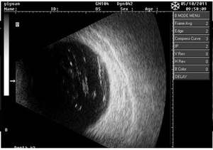 Dispositivo <span class=keywords><strong>de</strong></span> Ultrasonido Oftálmico Innovue Opto OAB-5000 con Escaneo A/B para la Detección <span class=keywords><strong>de</strong></span> Tumores Oculares - Product Image 2