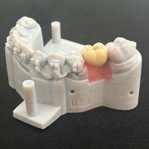 Laboratoire <span class=keywords><strong>dentaire</strong></span> de Chine fraisant tout sur 4 pont de couronne de zircone d'implant avec des piliers en titane - Product Image 6