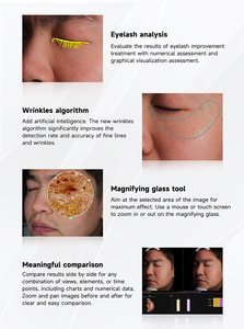AI Diagnostics Escáner de piel 3D Probador facial Analizador de piel para estética - Product Image 5