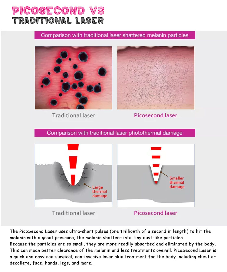 Multifunctional beauty machine carbon peeling and eyebrow tattoo removal picosecond laser tattoo removal machine price