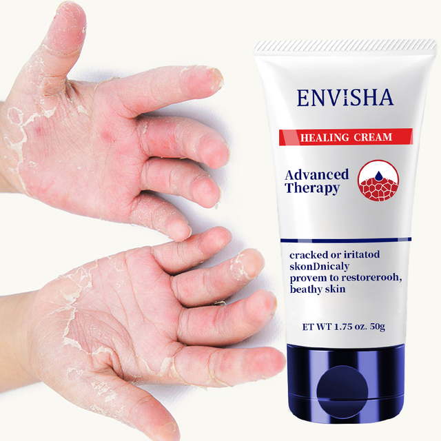 Natural Dry Hand and Feet Dry Cracked Skin Moisturizer Multi-Purpose Healing Ointment Cream