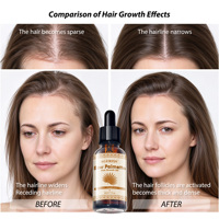Serum Kepadatan Minyak Biji Labu & Ekstrak Saw Palmetto untuk Pertumbuhan Rambut 10X Lebih Ampuh Perawatan Kulit Kepala Terarah dengan Campuran Minyak Jarak