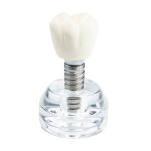 Modèle de couronne d'implant dentaire avec vis en titane sur base transparente pour l'enseignement - Product Image 1