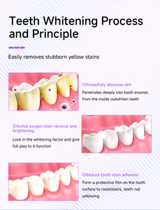 <span class=keywords><strong>V34</strong></span> Tiras Blanqueadoras de <span class=keywords><strong>Dientes</strong></span> Moradas, Tipo Carillas, Sin Peróxido, CP PAP, Personalizadas, Eliminador de Amarillo en <span class=keywords><strong>Dientes</strong></span> - Product Image 3