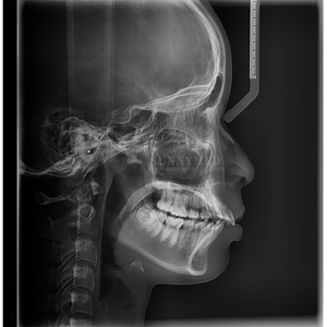 SY-M060 Appareil <span class=keywords><strong>panoramique</strong></span> céphalométrique de haute précision à double capteur indépendant pour la mesure et le diagnostic de l'arcade <span class=keywords><strong>dentaire</strong></span> en clinique orthodontique - Product Image 1