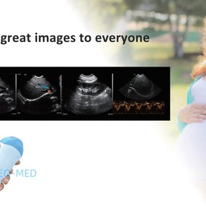 Sonde microconvexe portable WiFi pour échographie vétérinaire avec 23h d'autonomie - Multi-modes pour urgences abdominales CU15 - Product Image 3