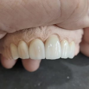 Kit de base en céramique de zircone BAOT PFZ, matériel de laboratoire <span class=keywords><strong>dentaire</strong></span> esthétique, zircone <span class=keywords><strong>dentaire</strong></span>, poudre de porcelaine <span class=keywords><strong>dentaire</strong></span> - Product Image 6