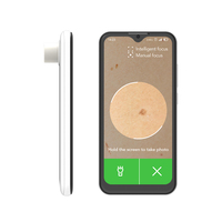 OEM-teléfono inteligente desbloqueado MT6739, 5 pulgadas, Android, con lente de aumento 4X/60X, dispositivo para el cuidado de la piel