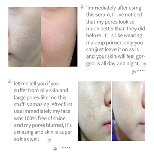 Sérums Resserreurs de Pores, Traitements Raffermissants, Contrôle du Sébum, Masque Nettoyant Visage, Sérum Réparateur de Pores, <span class=keywords><strong>Essence</strong></span> Réparatrice de Pores - Product Image 5