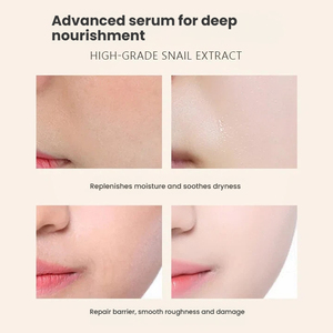 Suero Facial y de Cuello Antienvejecimiento Coreano Personalizado MLM, 96% de Baba de Caracol, Cuidado de la Piel, Blanqueamiento, Reparación, para Piel Sensible - Product Image 3