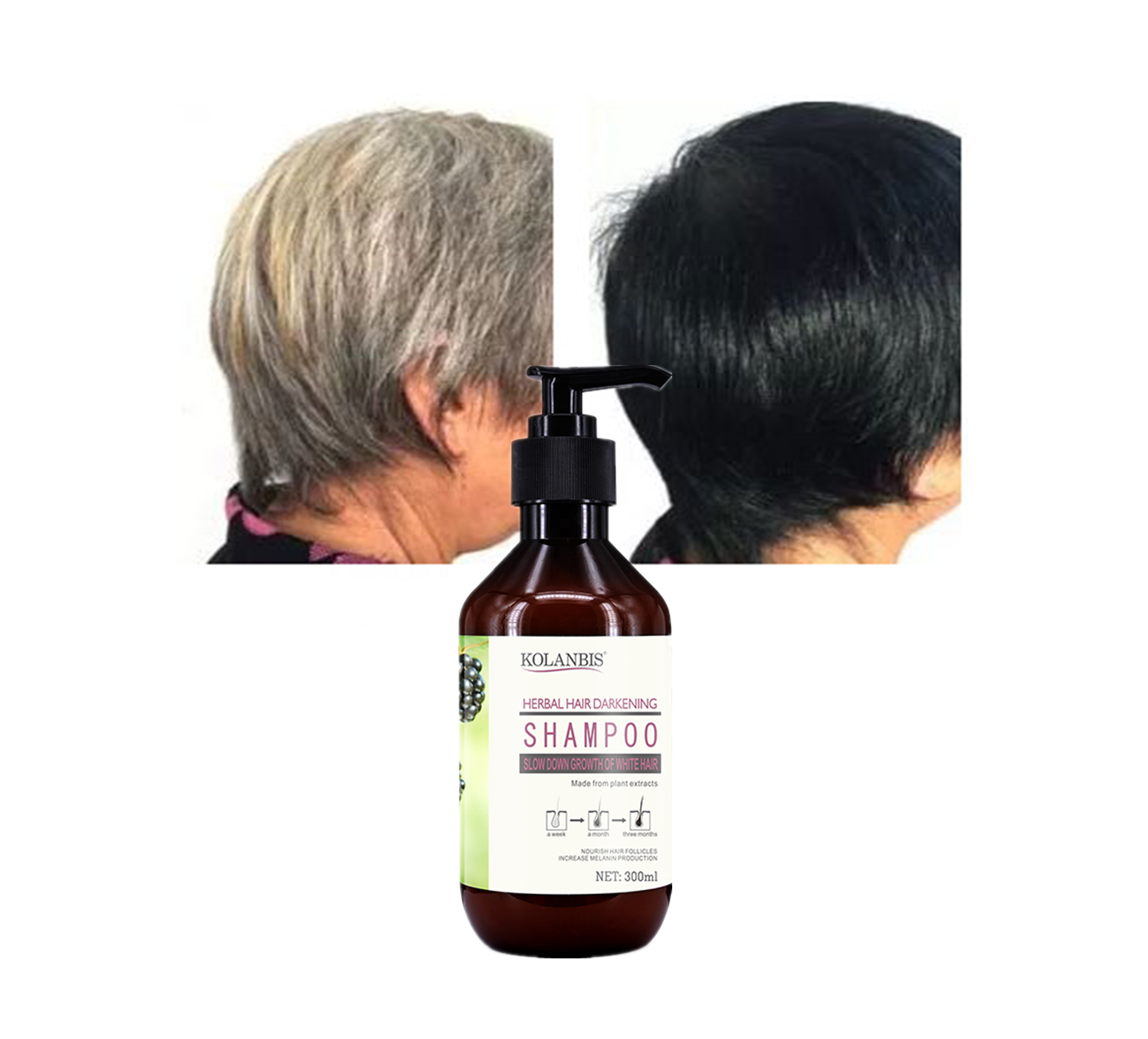 KOLANBIS, оптовая продажа, экстракт корня имбиря Morus Alba, шампунь для окрашивания черных волос, продукты для защиты от белых и седых волос, фирменная торговая марка