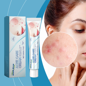 Crema viso per la riparazione dell'acne della luna del sud per segni di Acne chiusi crema detergente muscolare che migliora il trattamento dell'acne - Product Image 2