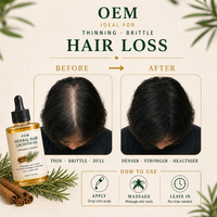 Traitement Professionnel de Réparation Capillaire, Huile de Croissance Capillaire Avancée aux Herbes, Réparation Naturelle du Cuir Chevelu, Vente en Gros OEM pour Salons
