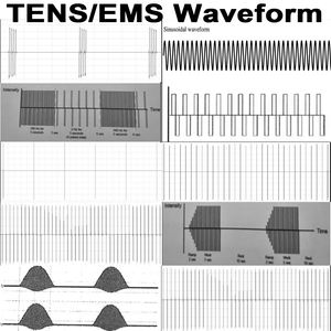 เครื่องกายภาพบำบัดแบบ Tens Ems รุ่น IFT RUSS รูปแบบคลื่นสี่เหลี่ยมสมมาตรแบบปรับได้ 60 โปรแกรม พร้อมโหมด Normal Burst Modulated - Product Image 6
