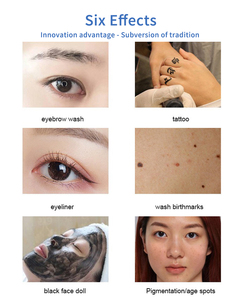 เครื่องลบรอยสักออลอินวัน 1064nm 755nm สำหรับล้างคิ้ว ใช้ได้กับใบหน้าและร่างกาย เหมาะสำหรับร้านเสริมสวย - Product Image 2