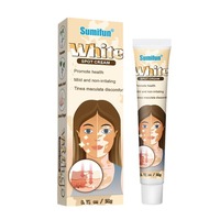 Traitement du Vitiligo Blanc : Pommade pour Améliorer et Atténuer les Taches Blanches Cutanées