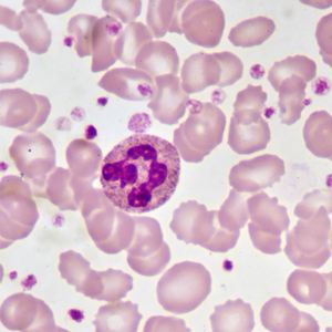 Reagente biochimico Stain Solutio Giemsa Stain / Giemsa Stainning Solution - Product Image 5