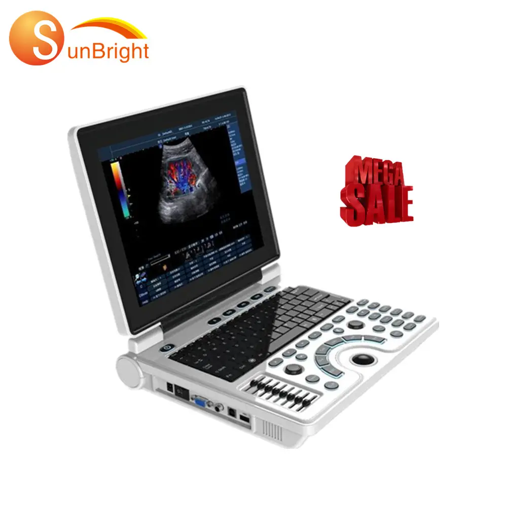 초음파 노트북 초음파 의료 검사 기계 의료 사용 휴대용 에코 기계