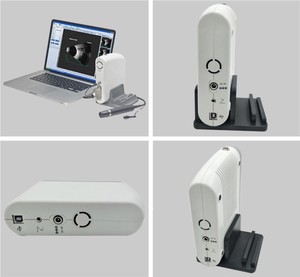 Holyavision เครื่องมือจักษุแบบพกพาเครื่องทดสอบตาอัลตราซาวนด์ AB สแกน - Product Image 2