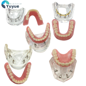 Modelo de cirugía dental y oral para nuevos productos de ciencia médica de implantación y Prostodoncia - Product Image 1