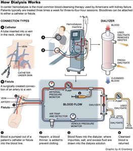 Tek kullanımlık tıbbi Hemodialyzer kartuş Haemodialysis kan filtresi tedavi hastane <span class=keywords><strong>Renal</strong></span> klinik nefrology cerrahi cihaz