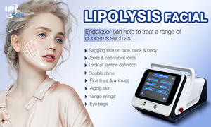 Taşınabilir 980 & 1470nm dalgaboyu lipoliz <span class=keywords><strong>Lipo</strong></span> diyot lazer makine cihazı cilt gençleştirme yüz kaldırma Endolif ab tak için - Product Image 5