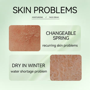 Crème Visage Apaisante à l'Aloe Vera Hydratante pour Peaux Sèches et Sensibles Soin Quotidien Nourrissant et Réparateur - Product Image 4
