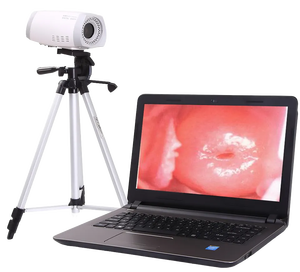 स्त्री रोग विज्ञान योनि परीक्षा के लिए सस्ते डिजिटल पोर्टेबल वीडियो कोलोपोस्कोप कैमरा - Product Image 3