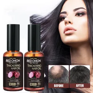 Custom Hair Straightening Olive Castor Oil Private Label Anti Loss Regrowth Scalp Hair Growth Oil Onion