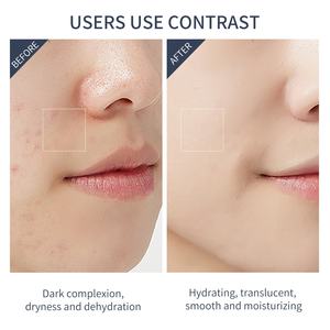 Masque facial japonais à l'arbutine de cerisier blanc 10 pièces éclaircit unifie le teint supprime les taches brunes de mélanine masque en feuille blanchissant - Product Image 6