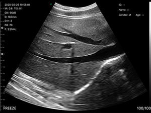 Usb Convexe Ultrasone <span class=keywords><strong>Transducer</strong></span> Draadloze Convexe Array Echografie Sonde Voor Ob/Gyn Long Urologie Toepassing - Product Image 6