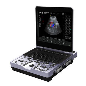 Ecógrafo Portátil Veterinario DMU83 de Diseño Moderno con Pantalla HD de 15.6 Pulgadas para Clínica y Hospital - Product Image 2