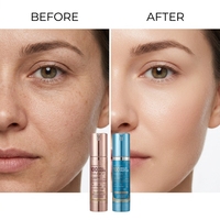 Échantillons de marque privée : Kit de sérum professionnel stérile pour microneedling, à base d'ADN de saumon coréen et d'acide hyaluronique, pour mésothérapie PRP